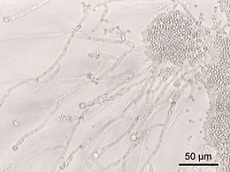 http://hu.wikipedia.org/wiki/Candida_albicans